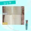 ミスタイトを使用しての、ひじ下のビフォーアフターです。